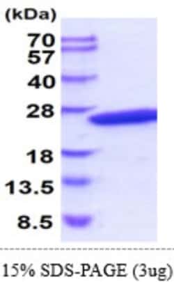 Novus Biologicals&trade;&nbsp;Recombinant Human CRYGD Protein